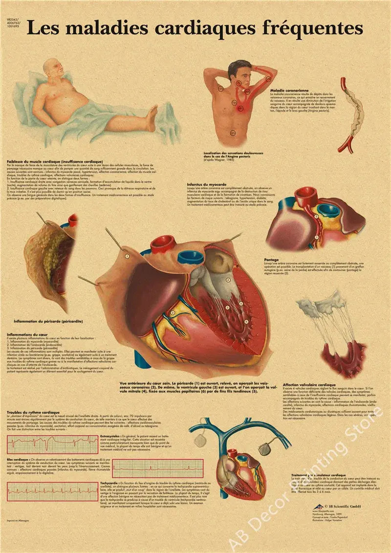 Retro Organ Systems In The Human Body Posters Skeleton Anatomy Kraft Paper Prints DIY Vintage Home Room Art Wall Decor Paintings June Wall Art