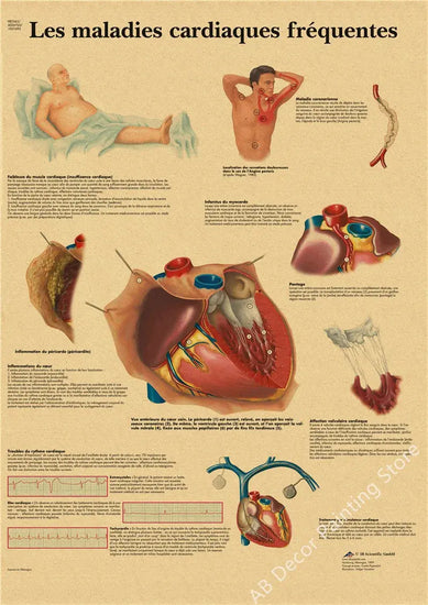 Retro Organ Systems In The Human Body Posters Skeleton Anatomy Kraft Paper Prints DIY Vintage Home Room Art Wall Decor Paintings June Wall Art